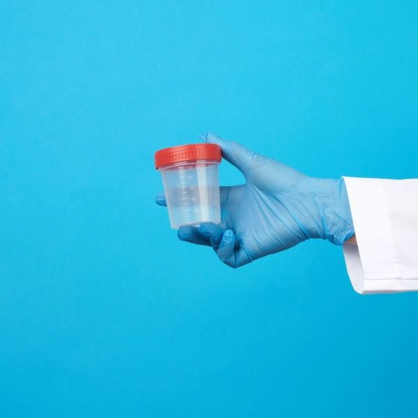 Numune Kabı 100 ml | 400 Adet | Steril Poşetli Numune Saklama Kabı