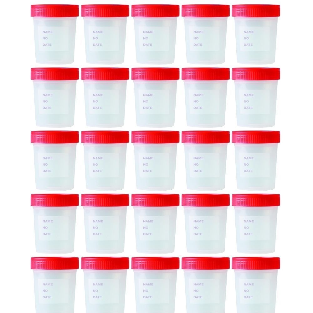 Numune Kabı 250 ml | 25 Adet | Steril Poşetli Numune Saklama Kabı