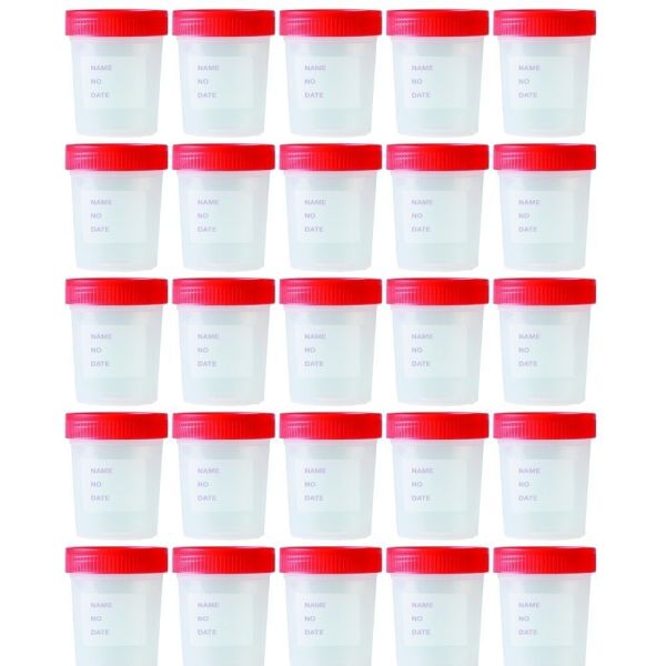 Numune Kabı 250 ml | 25 Adet | Steril Poşetli Numune Saklama Kabı